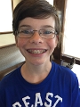Alex_Braces_2017 (2)